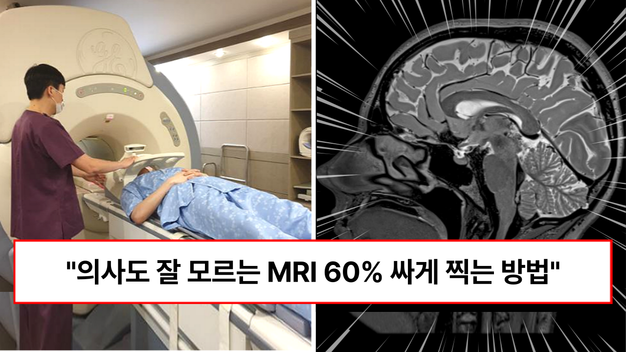 “모르고 찍으면 호구됩니다” 비싼 MRI 호갱 당하지 않고 60% 싸게 찍는 꿀팁 (+4가지)